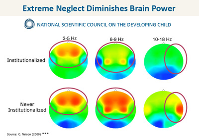 Neglected Child Brain